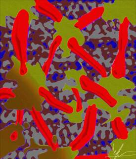 Magnified CVI