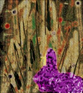 Peter Cottontail in Dissociative Fugue