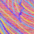 torn sinew