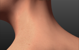 Neck